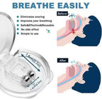 Anti Snoring Nose Clip Device for Men Women Nasal Strips Stops Snoring Stopper Anti-snoring Device (Nose Clip)